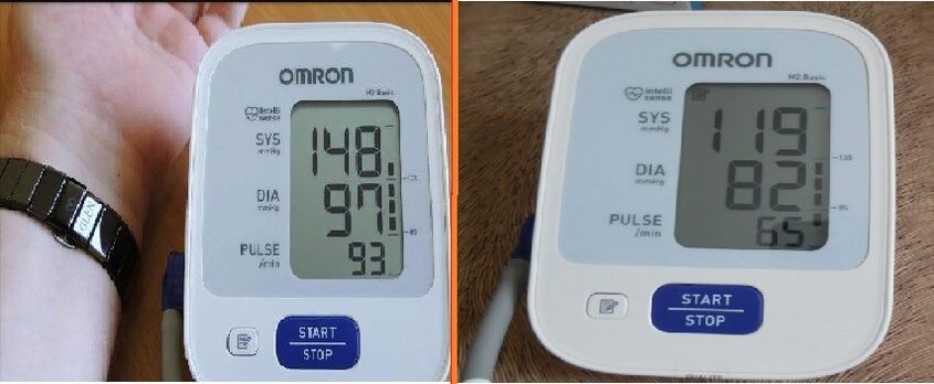 tanometer index before and after using Cardione